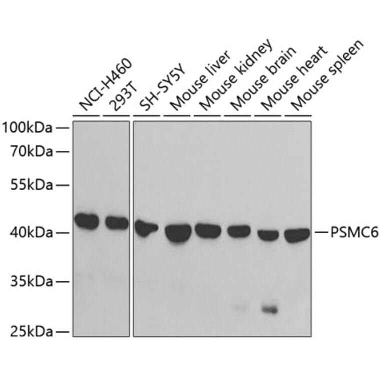 Western Blot - Anti-PSMC6 Antibody (A14715) - Antibodies.com