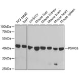 Western Blot - Anti-PSMC6 Antibody (A14715) - Antibodies.com