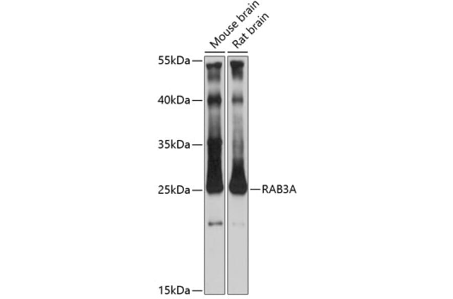Western Blot - Anti-Rab3A Antibody (A14716) - Antibodies.com
