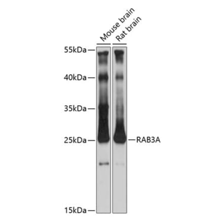 Western Blot - Anti-Rab3A Antibody (A14716) - Antibodies.com