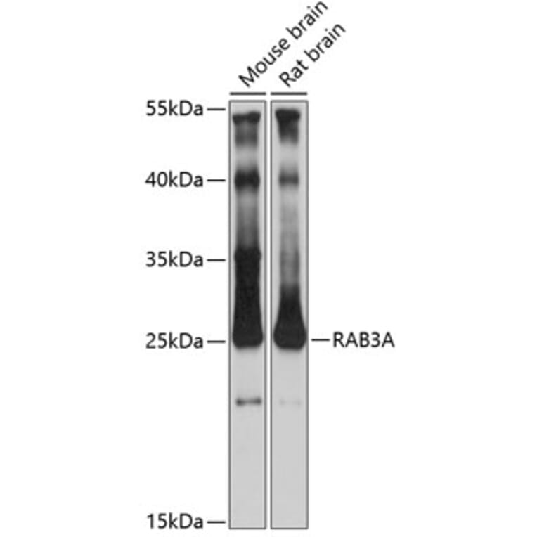 Western Blot - Anti-Rab3A Antibody (A14716) - Antibodies.com