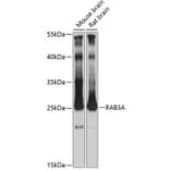 Western Blot - Anti-Rab3A Antibody (A14716) - Antibodies.com