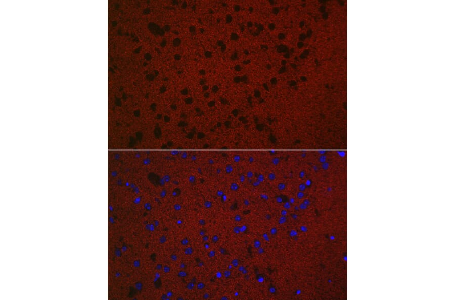 Immunofluorescence - Anti-Rab3A Antibody (A14716) - Antibodies.com