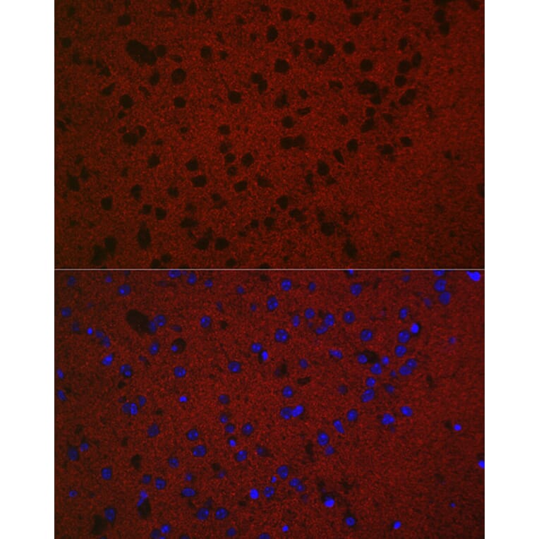 Immunofluorescence - Anti-Rab3A Antibody (A14716) - Antibodies.com