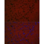 Immunofluorescence - Anti-Rab3A Antibody (A14716) - Antibodies.com