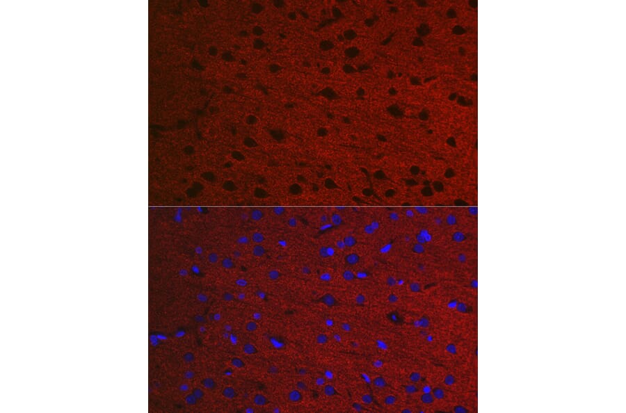Immunofluorescence - Anti-Rab3A Antibody (A14716) - Antibodies.com