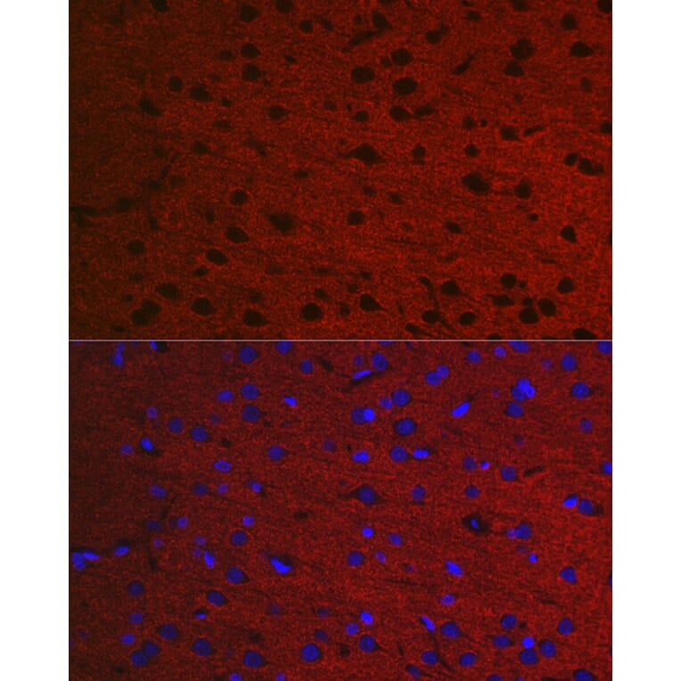 Immunofluorescence - Anti-Rab3A Antibody (A14716) - Antibodies.com