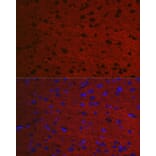 Immunofluorescence - Anti-Rab3A Antibody (A14716) - Antibodies.com