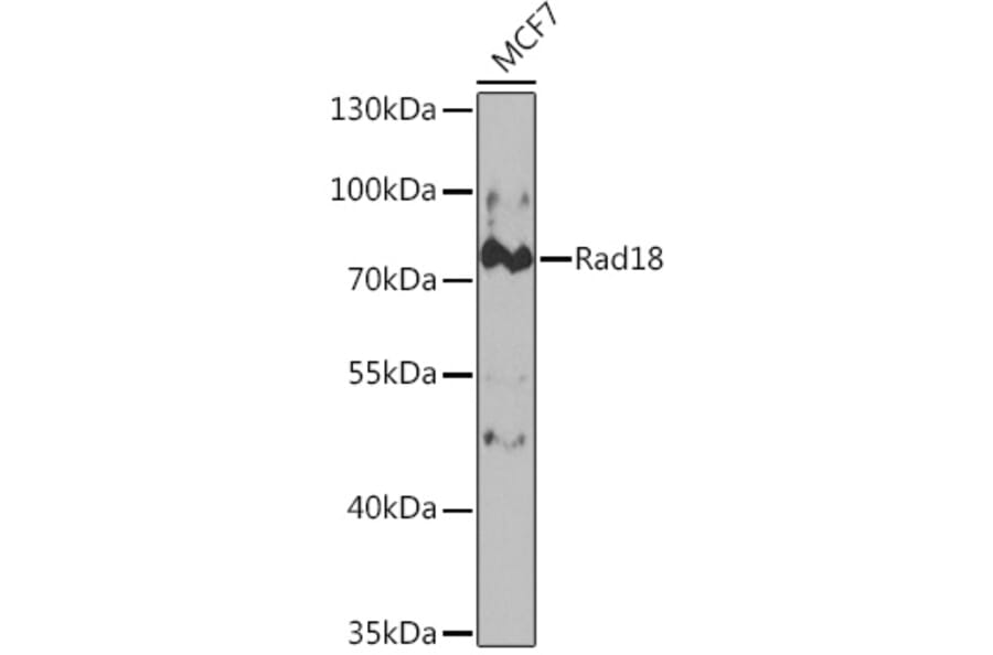 Western Blot - Anti-RAD18 Antibody (A14717) - Antibodies.com