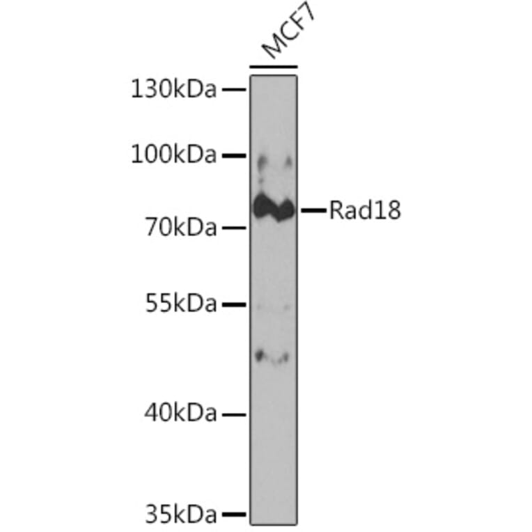 Western Blot - Anti-RAD18 Antibody (A14717) - Antibodies.com