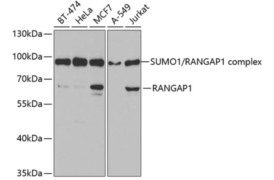 Western Blot - Anti-RanGAP1 Antibody (A14718) - Antibodies.com