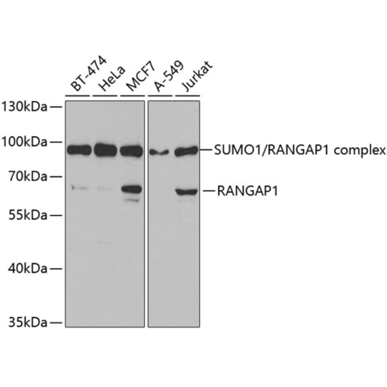 Western Blot - Anti-RanGAP1 Antibody (A14718) - Antibodies.com