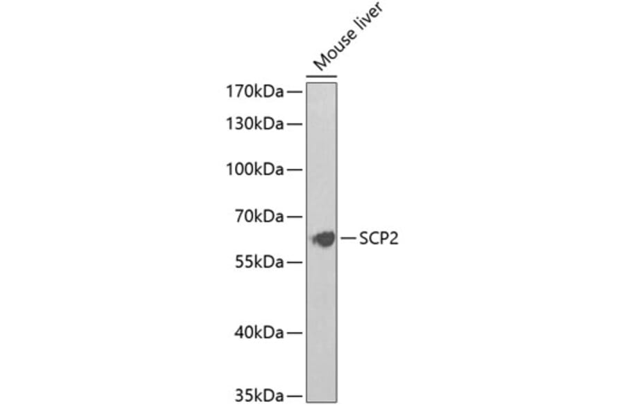 Western Blot - Anti-Sterol carrier protein 2 Antibody (A14719) - Antibodies.com