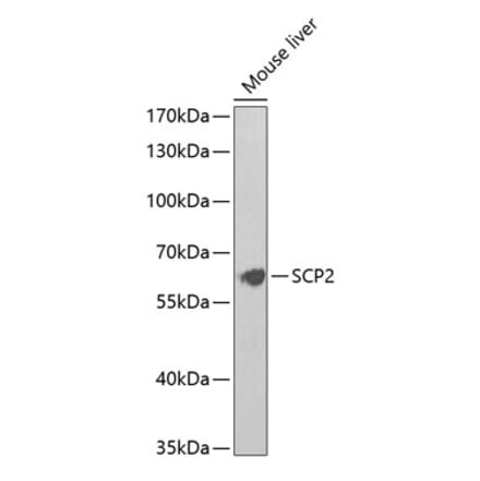Western Blot - Anti-Sterol carrier protein 2 Antibody (A14719) - Antibodies.com