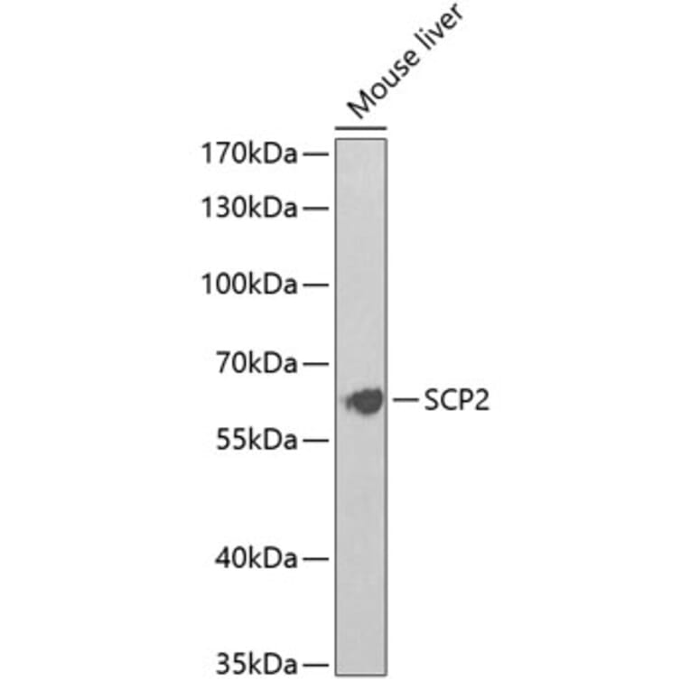Western Blot - Anti-Sterol carrier protein 2 Antibody (A14719) - Antibodies.com