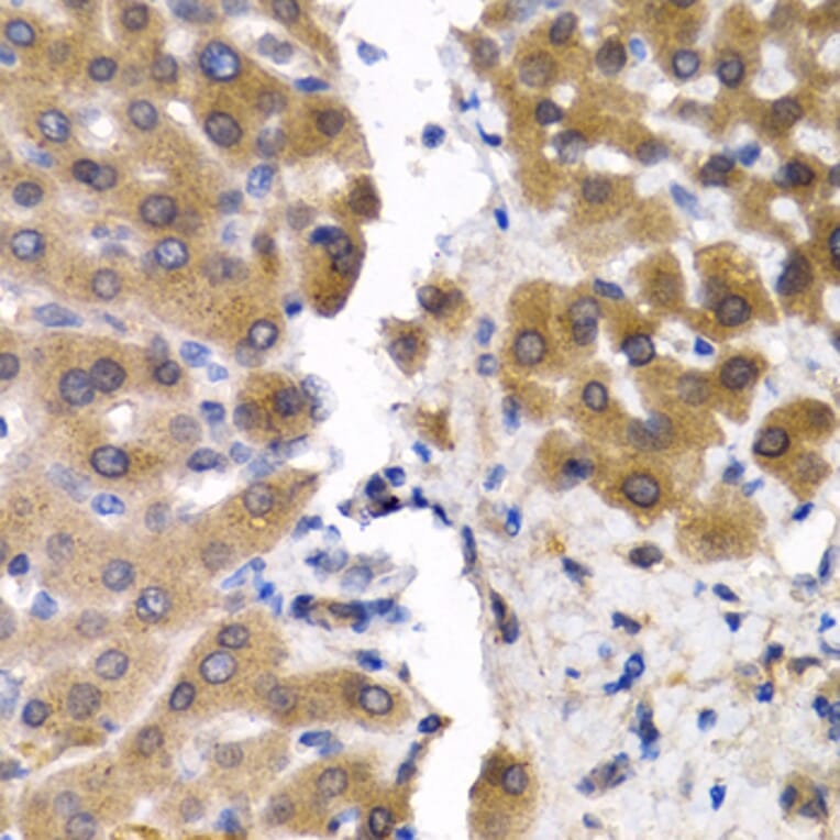 Immunohistochemistry - Anti-Sterol carrier protein 2 Antibody (A14719) - Antibodies.com