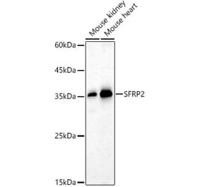Western Blot - Anti-SFRP2 Antibody (A14720) - Antibodies.com