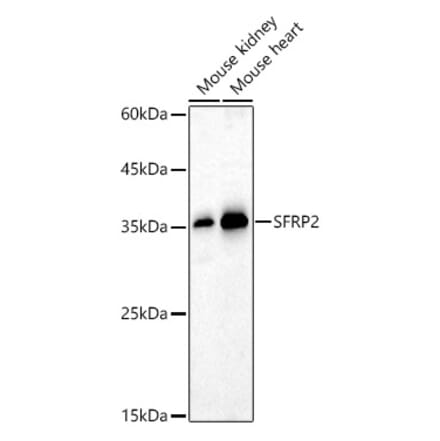 Western Blot - Anti-SFRP2 Antibody (A14720) - Antibodies.com