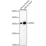 Western Blot - Anti-SFRP2 Antibody (A14720) - Antibodies.com