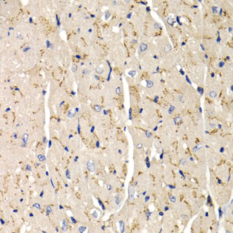 Immunohistochemistry - Anti-SFRP2 Antibody (A14720) - Antibodies.com