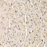 Immunohistochemistry - Anti-SFRP2 Antibody (A14720) - Antibodies.com