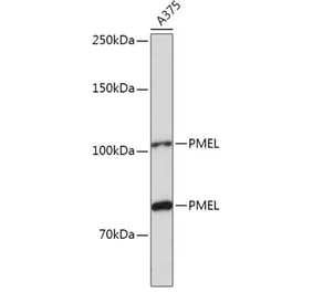 Western Blot - Anti-Melanoma gp100 Antibody (A14721) - Antibodies.com