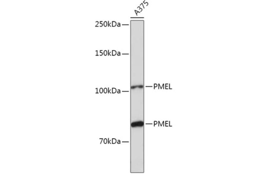 Western Blot - Anti-Melanoma gp100 Antibody (A14721) - Antibodies.com