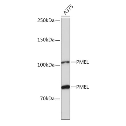 Western Blot - Anti-Melanoma gp100 Antibody (A14721) - Antibodies.com
