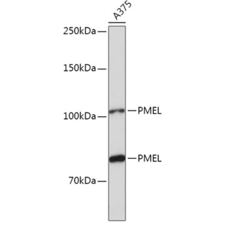 Western Blot - Anti-Melanoma gp100 Antibody (A14721) - Antibodies.com