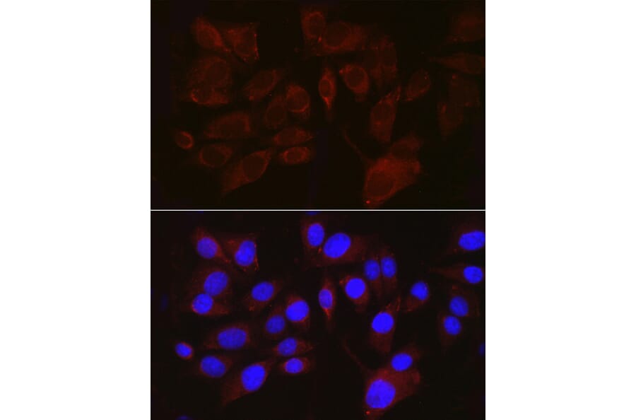 Immunofluorescence - Anti-Melanoma gp100 Antibody (A14721) - Antibodies.com