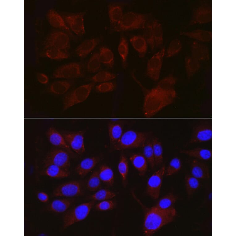 Immunofluorescence - Anti-Melanoma gp100 Antibody (A14721) - Antibodies.com