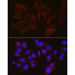 Immunofluorescence - Anti-Melanoma gp100 Antibody (A14721) - Antibodies.com