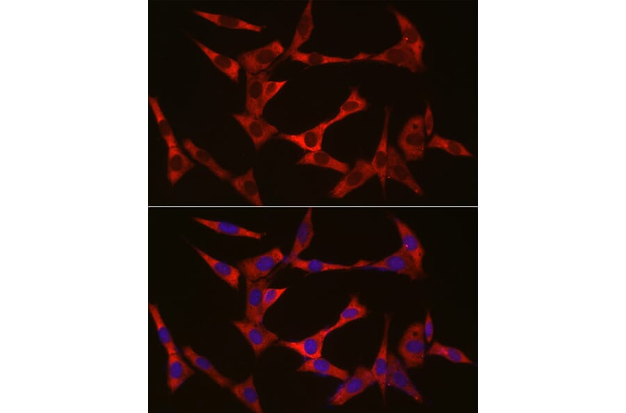 Immunofluorescence - Anti-WIF1 Antibody (A14722) - Antibodies.com