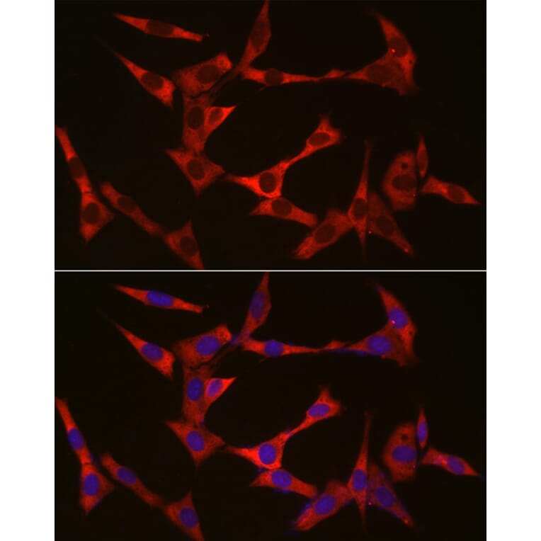 Immunofluorescence - Anti-WIF1 Antibody (A14722) - Antibodies.com