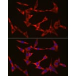 Immunofluorescence - Anti-WIF1 Antibody (A14722) - Antibodies.com