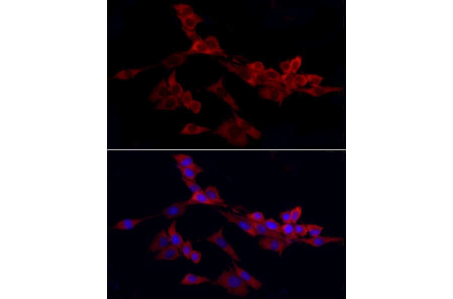 Immunofluorescence - Anti-WIF1 Antibody (A14722) - Antibodies.com