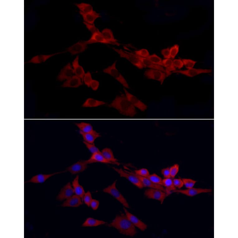 Immunofluorescence - Anti-WIF1 Antibody (A14722) - Antibodies.com