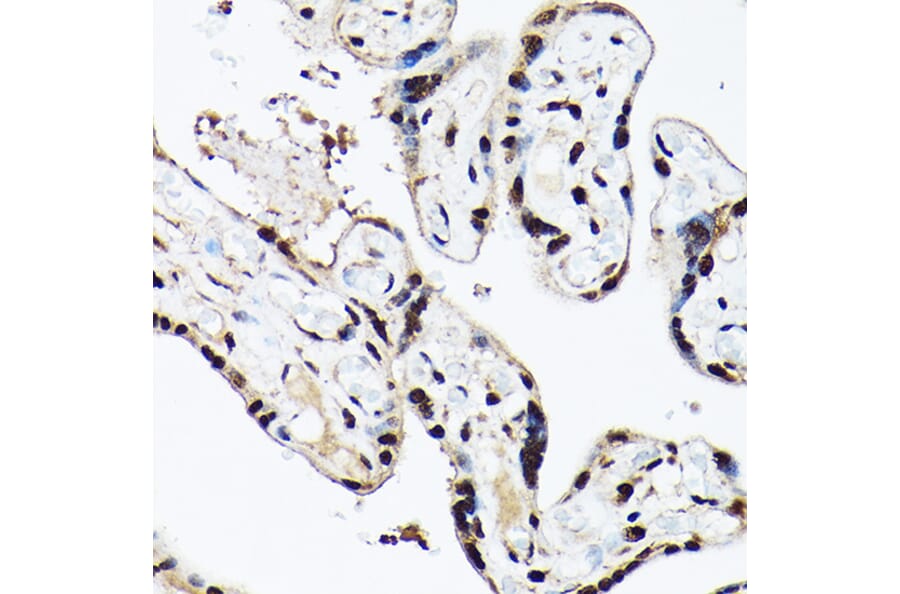 Immunohistochemistry - Anti-ACTL6A Antibody (A14723) - Antibodies.com
