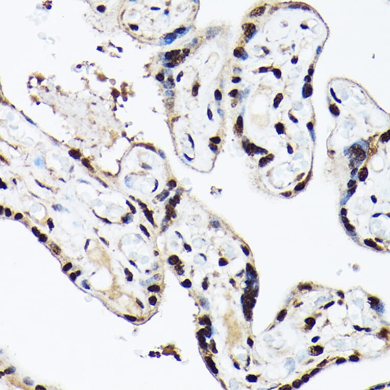 Immunohistochemistry - Anti-ACTL6A Antibody (A14723) - Antibodies.com
