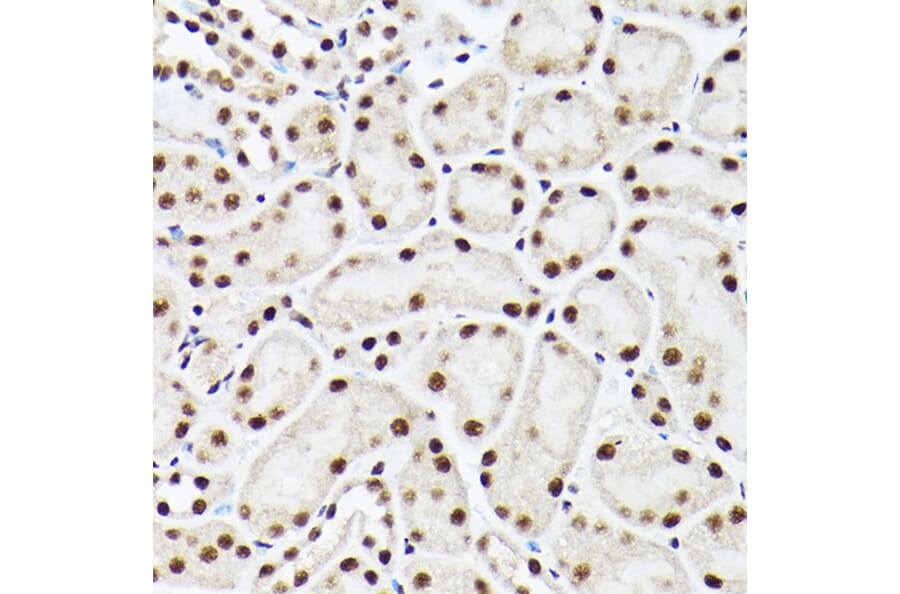 Immunohistochemistry - Anti-ACTL6A Antibody (A14723) - Antibodies.com