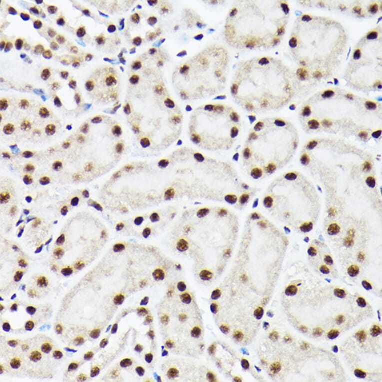 Immunohistochemistry - Anti-ACTL6A Antibody (A14723) - Antibodies.com