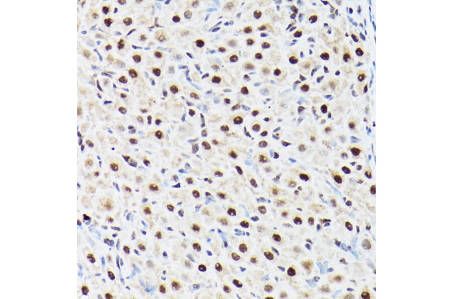 Immunohistochemistry - Anti-ACTL6A Antibody (A14723) - Antibodies.com