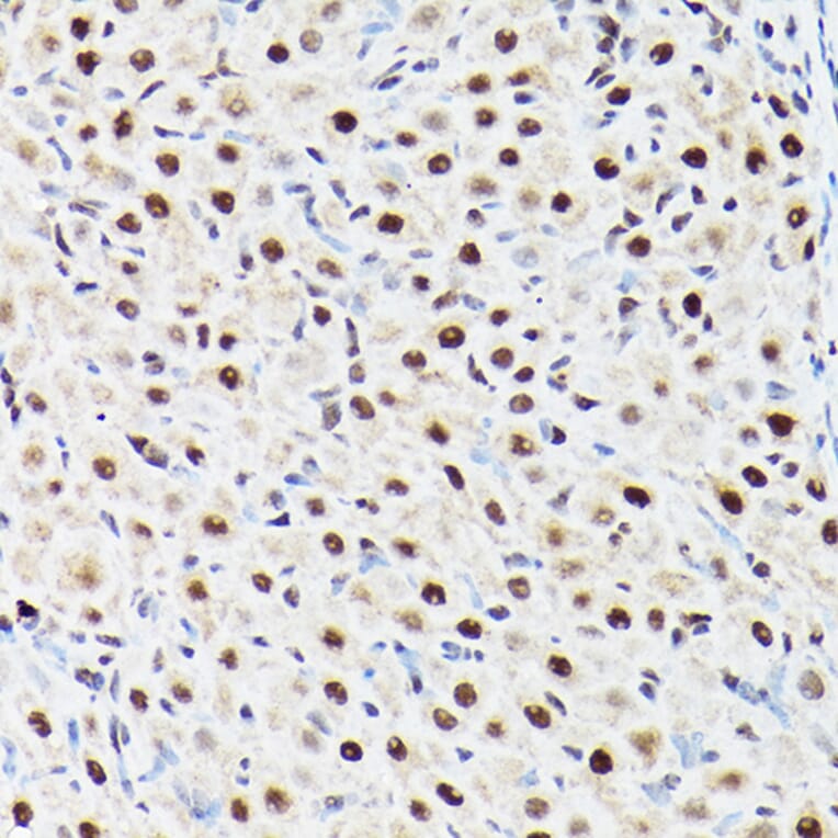 Immunohistochemistry - Anti-ACTL6A Antibody (A14723) - Antibodies.com