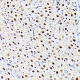 Immunohistochemistry - Anti-ACTL6A Antibody (A14723) - Antibodies.com