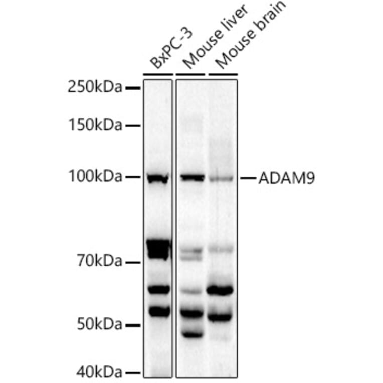 Western Blot - Anti-ADAM9 Antibody (A14724) - Antibodies.com