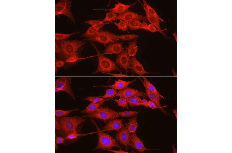 Immunofluorescence - Anti-ADAM9 Antibody (A14724) - Antibodies.com