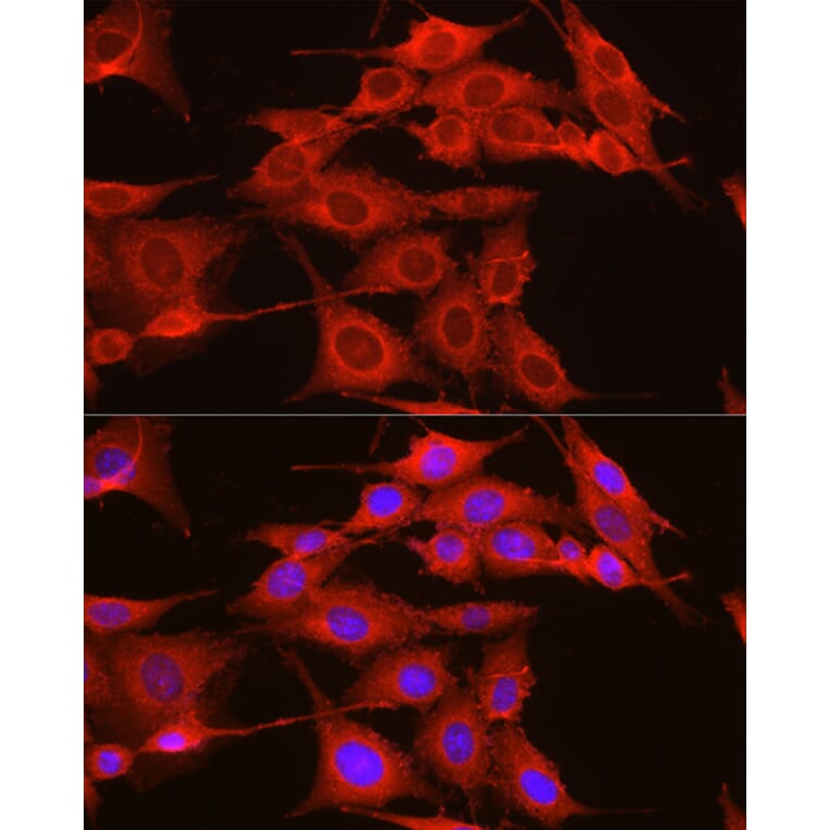 Immunofluorescence - Anti-ADAM9 Antibody (A14724) - Antibodies.com