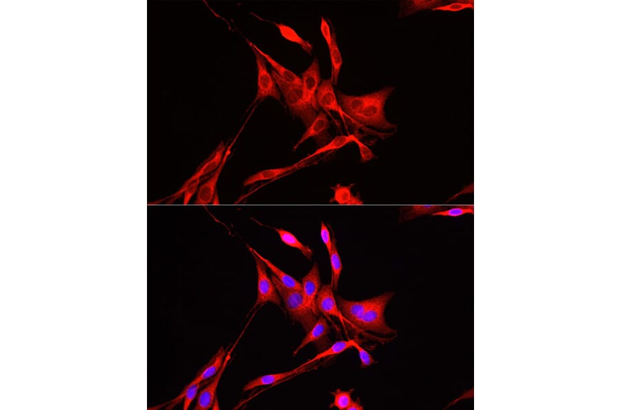 Immunofluorescence - Anti-ADAM9 Antibody (A14724) - Antibodies.com