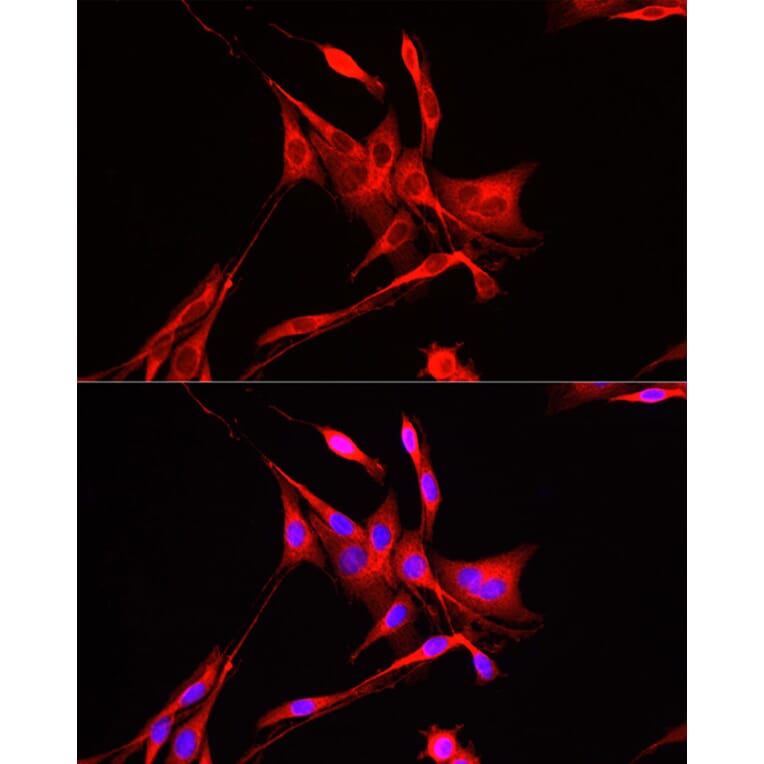 Immunofluorescence - Anti-ADAM9 Antibody (A14724) - Antibodies.com