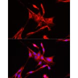 Immunofluorescence - Anti-ADAM9 Antibody (A14724) - Antibodies.com
